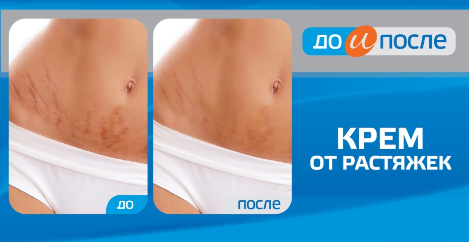 Крем От Растяжек В Аптеке Крем От Растяжек В Аптеке