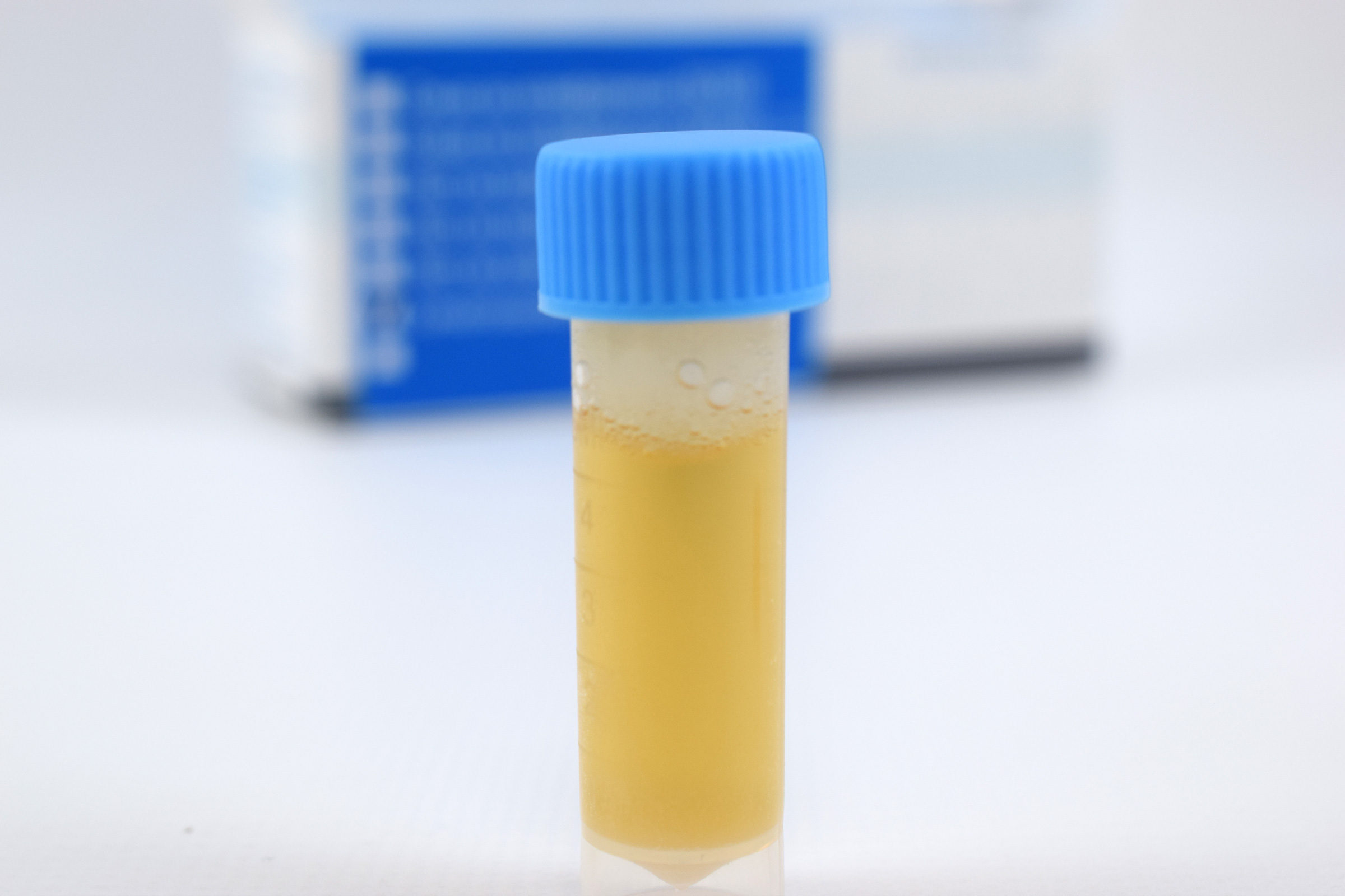 Альтернатива выпускает петритест на сульфатредуцирующих бактерии