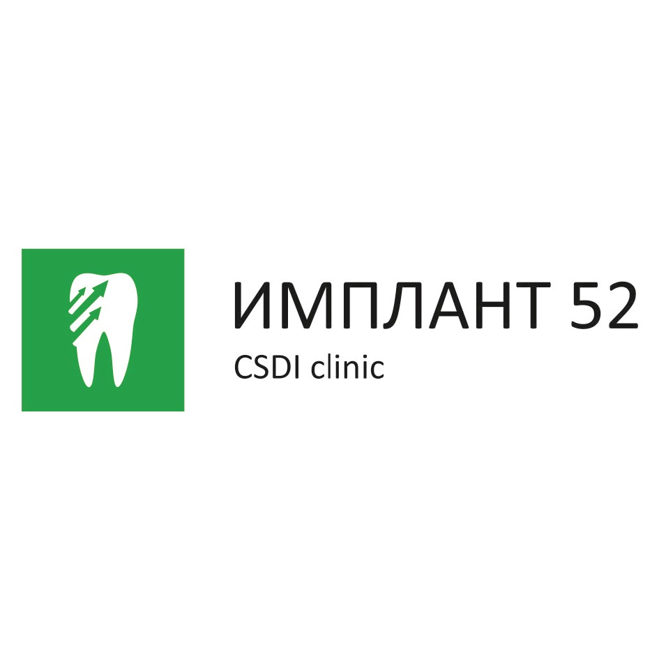 Имплант 52 отзывы